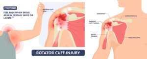 Rotator cuff tears causing pain in shoulder