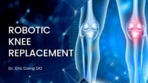 Robotic knee replacement surgery, Modesto, CA