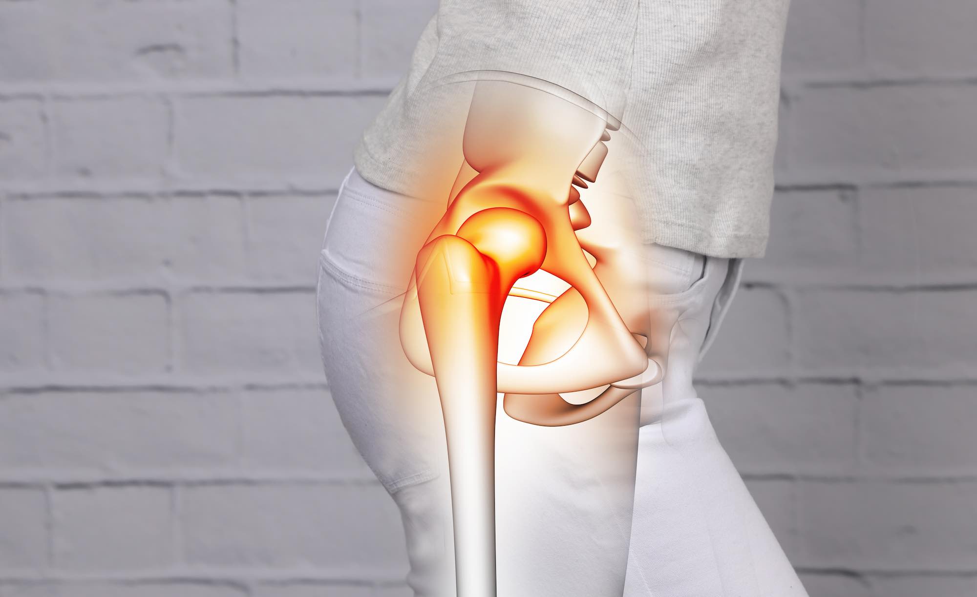 Hip Pain: What are the Causes & Solutions
