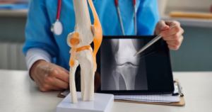 Robotic Total Knee Surgery