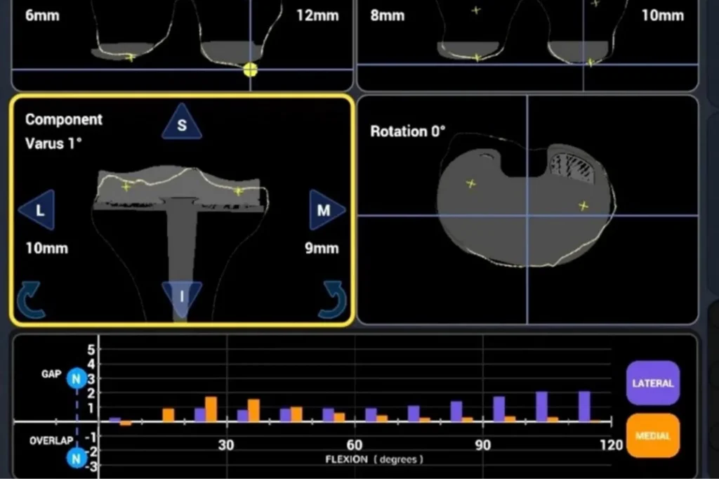 NAVIO system planning