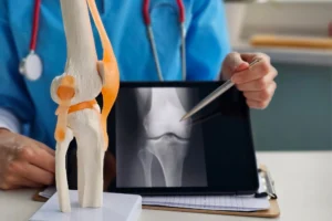 Doctor with knee xray