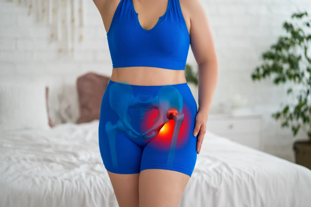hip_replacement_diagram female patient with hip replacement.