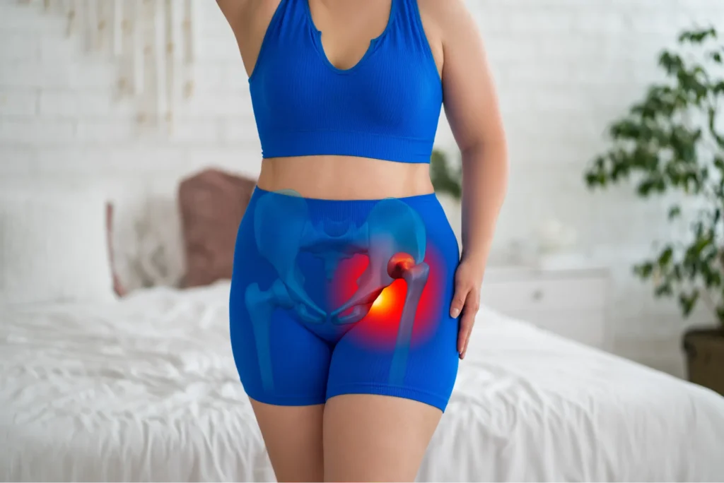 hip replacement diagram female patient with hip replacement.