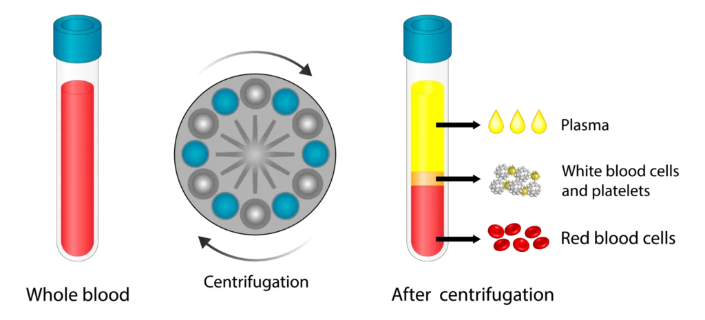 A diagram showing the PRP process. 