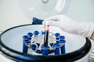 Creating PRP in a centrifuge.