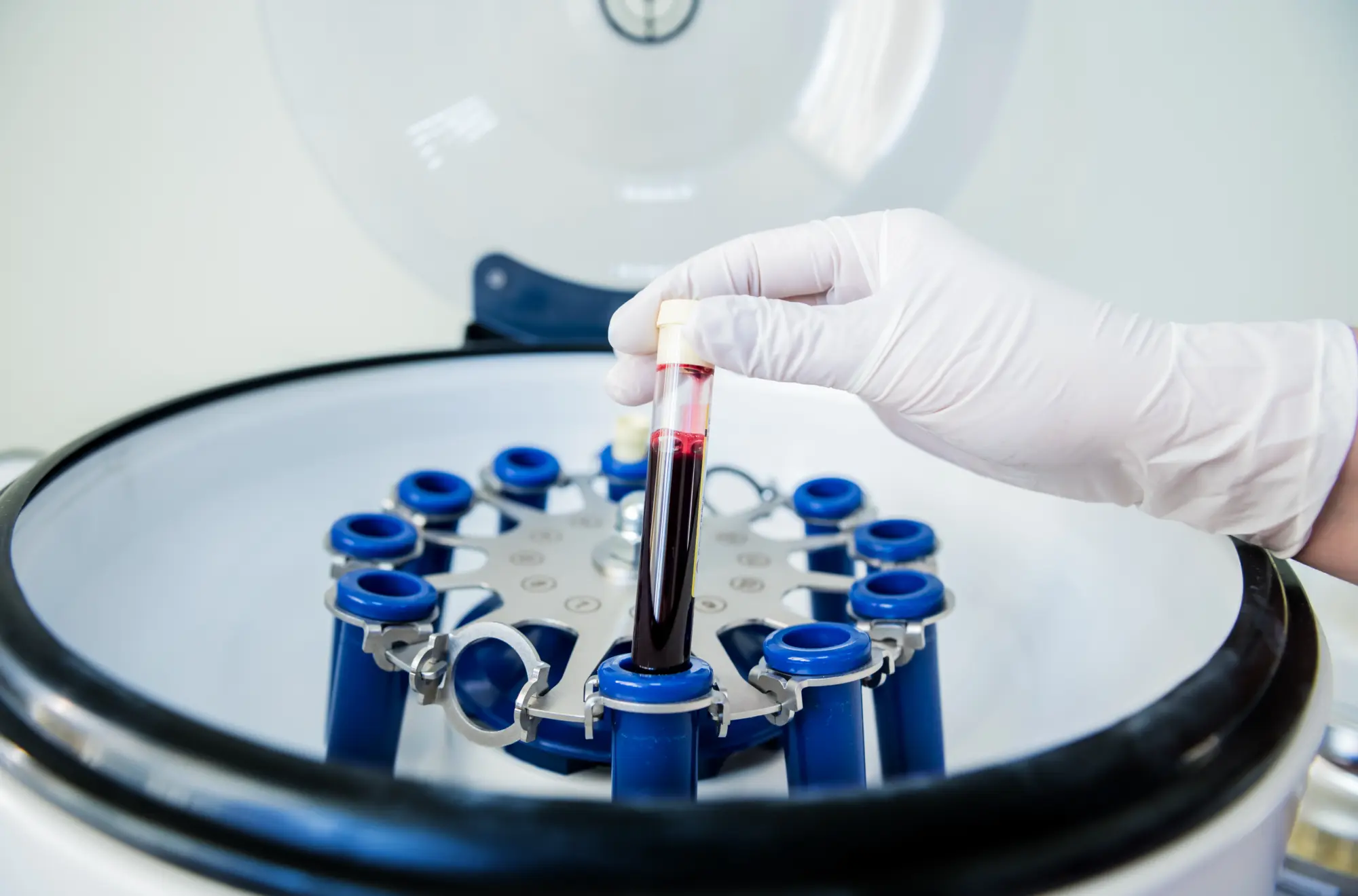 Creating PRP in a centrifuge.
